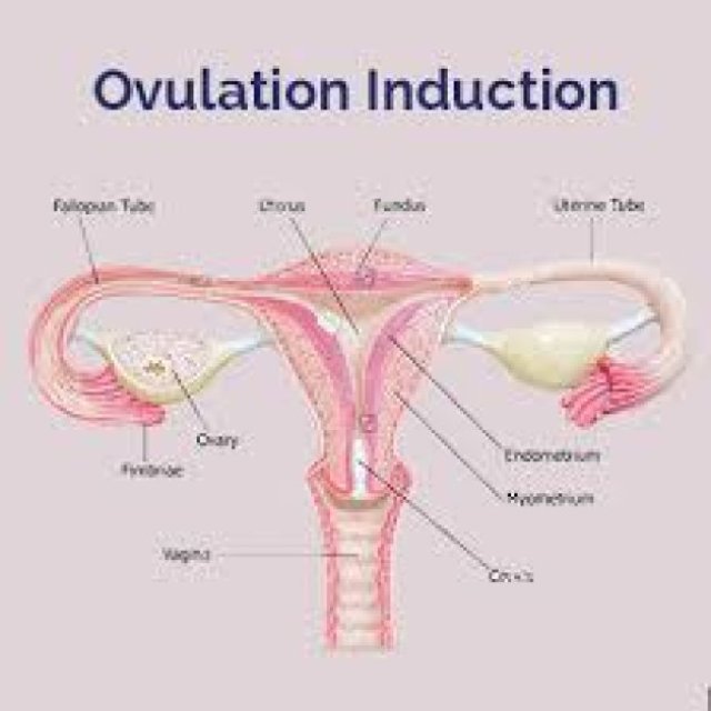 Optimal Ovulation Induction (OI) at Dr. Ankita's Fertility Center