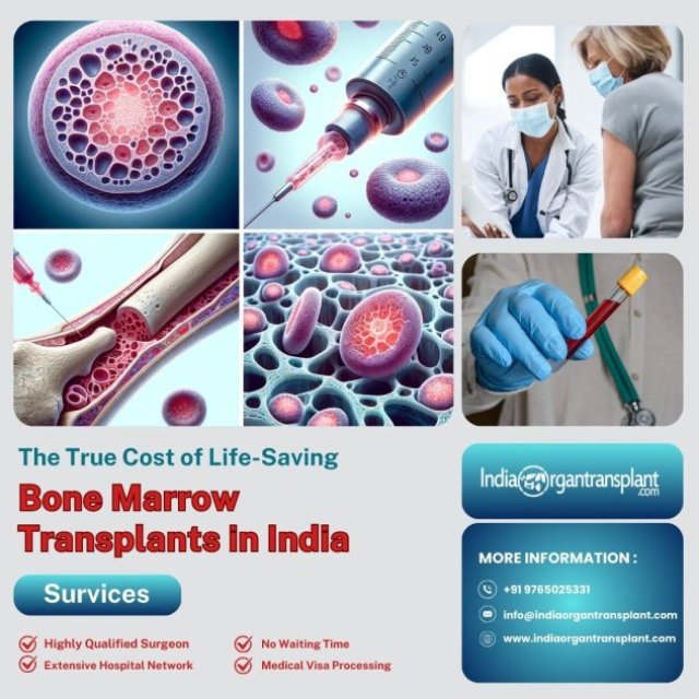 Average Cost of Bone Marrow Transplant Surgery in India