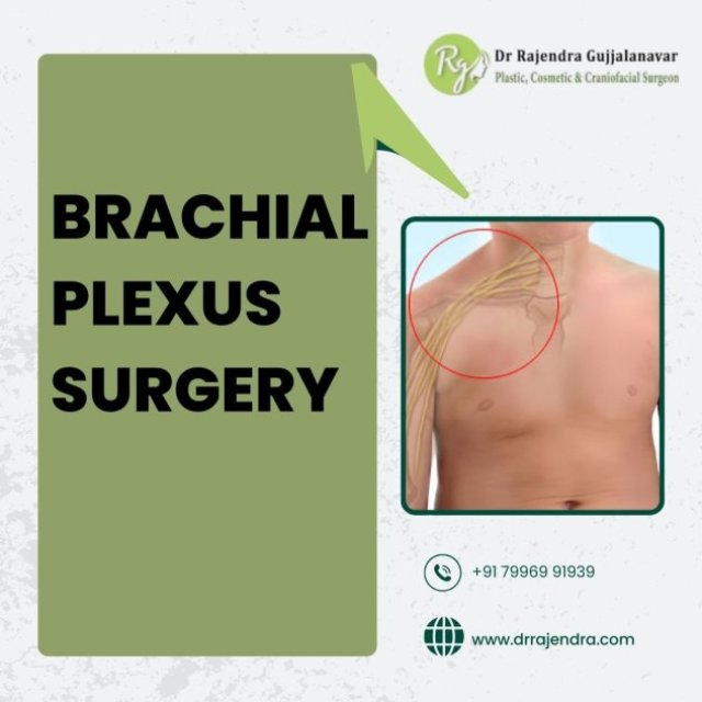 Brachial Plexus Surgery - Top Plastic Surgeon Of Bangalore