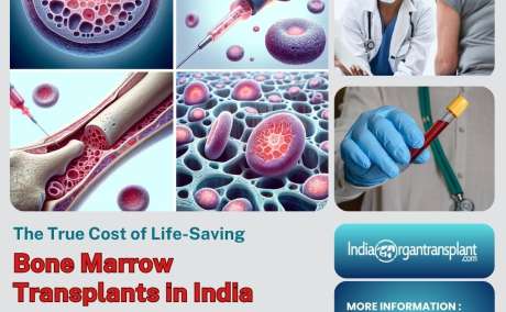 Average Cost of Bone Marrow Transplant Surgery in India