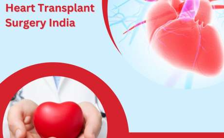 Best Package For Heart Transplant Surgery in India