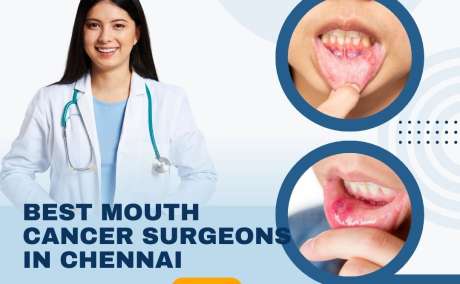 Oral Cancer Treatment Doctors In Chennai | +91 96633 03747