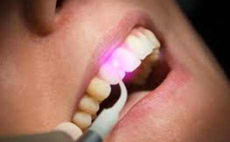 PAINLESS DIGITAL ANAESTHESIA-THE WAND