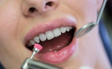 Do your teeth look yellow or dull? Want a safe way to get a whiter smile?
