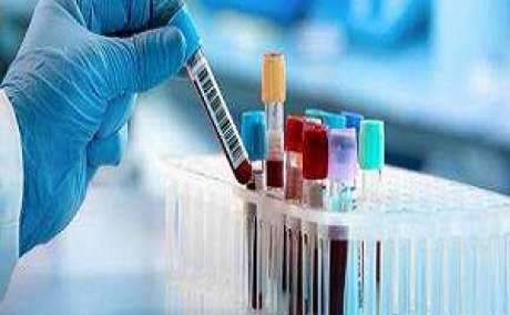 Book Beta HCG Blood Test in Delhi at Low Cost