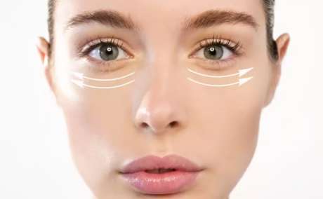 Eye Bag Treatment Sharjah | Bellaphi