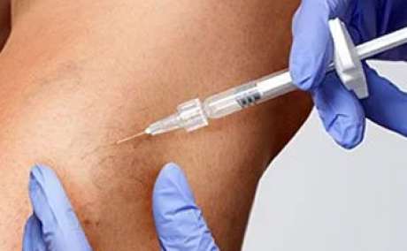 Sclerotherapy Treatment In Pune - Karishma Vein