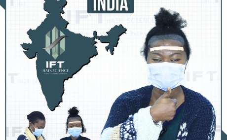 best female hair transplant doctor in India