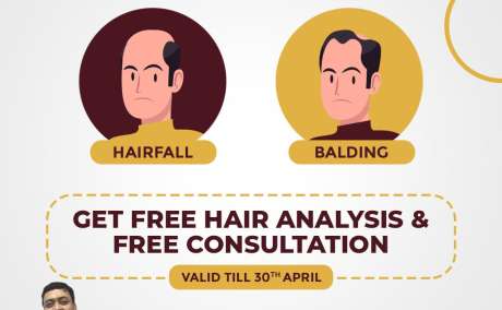 Hair Transplant Cost in Chandigarh - Treatment by Dr Rahul Goyal