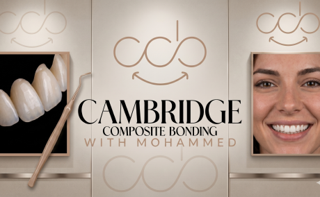 Achieve a Confident Smile with Composite Bonding Cambridge