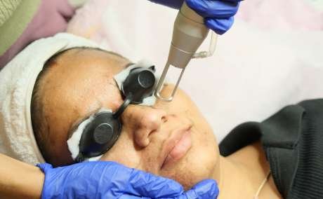 Advanced Aesthetic Treatments - Laser & Body Contouring in Hyderabad | Koniki Luxe