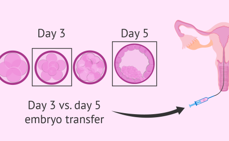 Blastocyst vs Day 3 Embryo Transfer: Success Rate & Cost