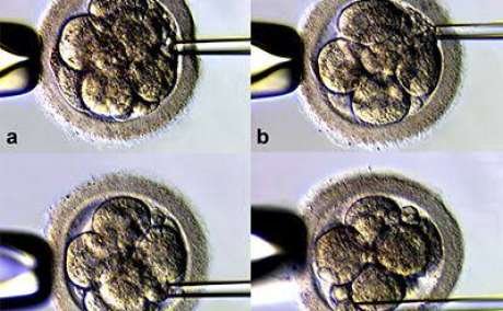 Assisted Embryo Hatching: Zona Pellucida Hatching Explained